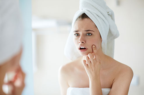 acne-1.jpg